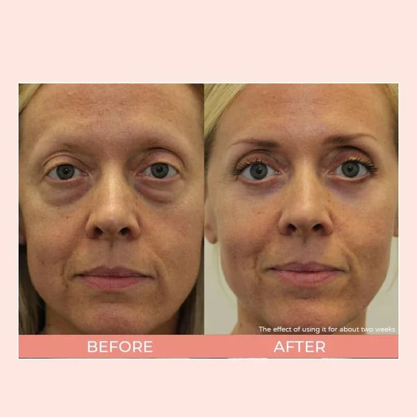 Heleyttävä Silmänympärysvoide SPF 41