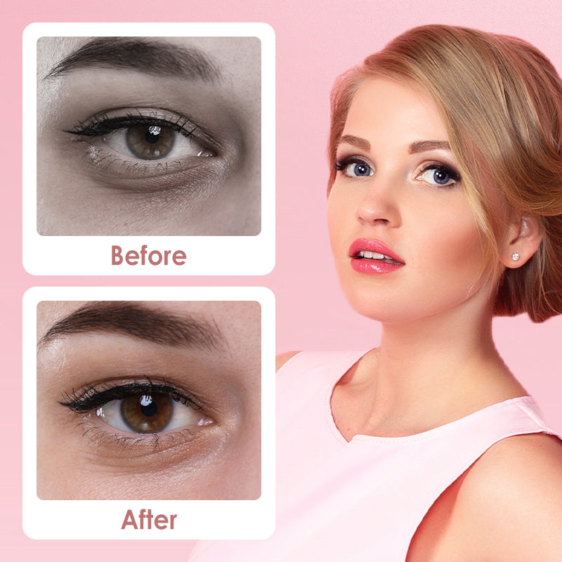 🔥 Viimeinen myyntipäivä 50 % ALENNUSTA 🔥 Under Eye Brightener – kirkastaa silmänaluset ja poistaa tummat varjot!