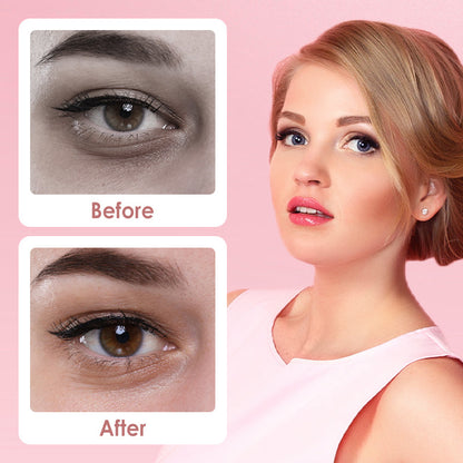 🔥 Viimeinen myyntipäivä 50 % ALENNUSTA 🔥 Under Eye Brightener – kirkastaa silmänaluset ja poistaa tummat varjot!